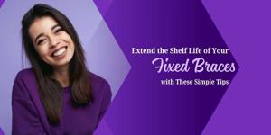 Extend the Shelf Life of Your Fixed Braces with These Simple Tips