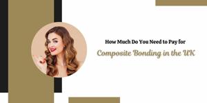 How Much Do You Need to Pay for Composite Bonding in the UK?