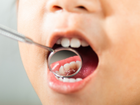 The Ultimate Guide to Choosing the Best Dentist in Five Dock