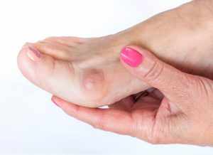 Beginning Signs of a Bunion | Sydney Bunion Clinic
