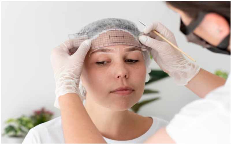 How to Achieve Perfect Brows with Eyebrow Hair Implants