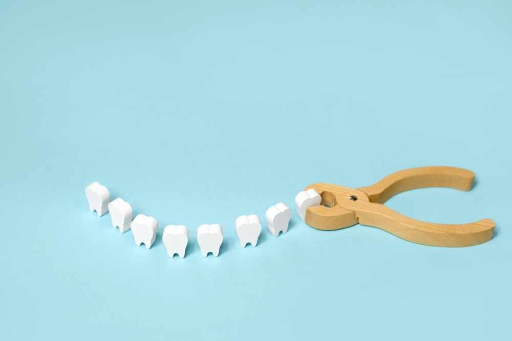 When Is Tooth Extraction Necessary? Signs You Shouldn’t Ignore