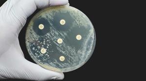 Antimicrobial Cap Fitters Market : Notable Developments and Geographical Outlook 2025 to 2035