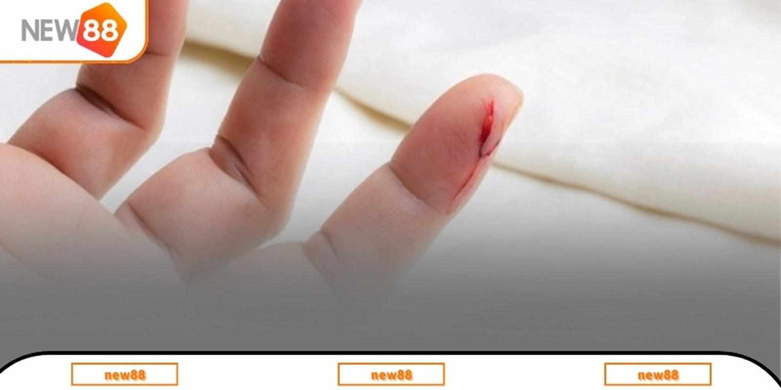 Giải mã giấc mơ nằm mơ thấy đứt tay dưới góc nhìn tâm lý