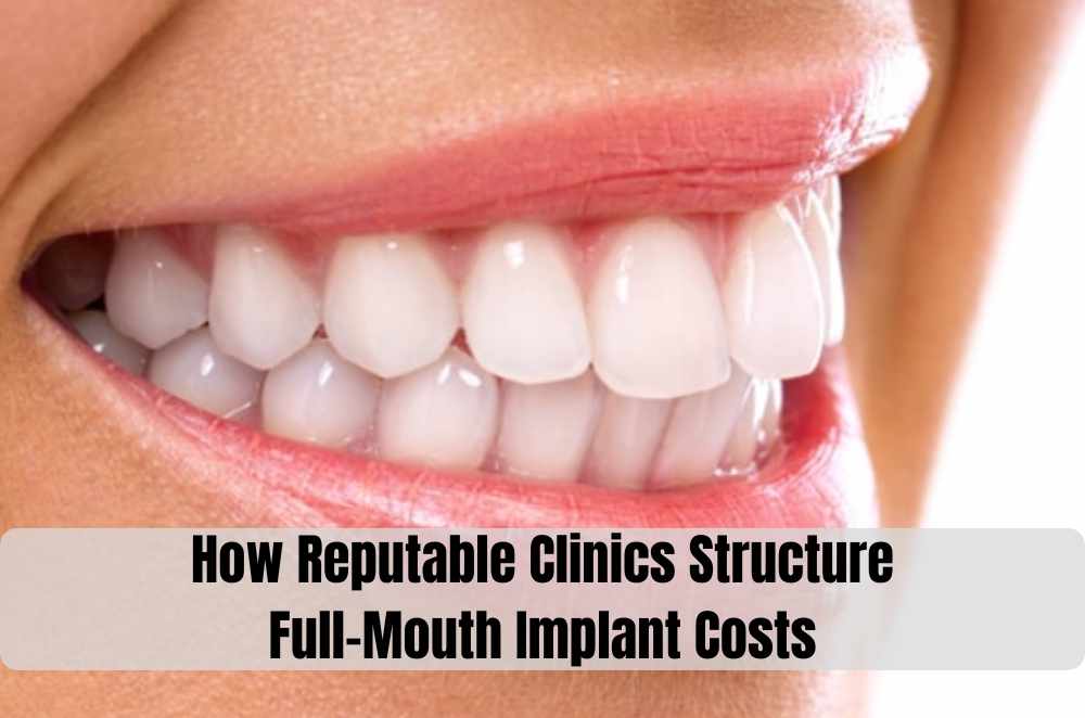 How Reputable Clinics Structure Full-Mouth Implant Costs