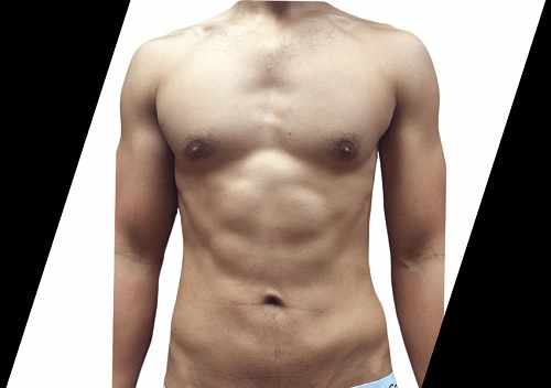 Achieve a Sculpted Look with Plastic Surgery for Men Houston