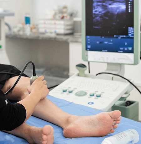 How Effective Is Spider Vein Removal?