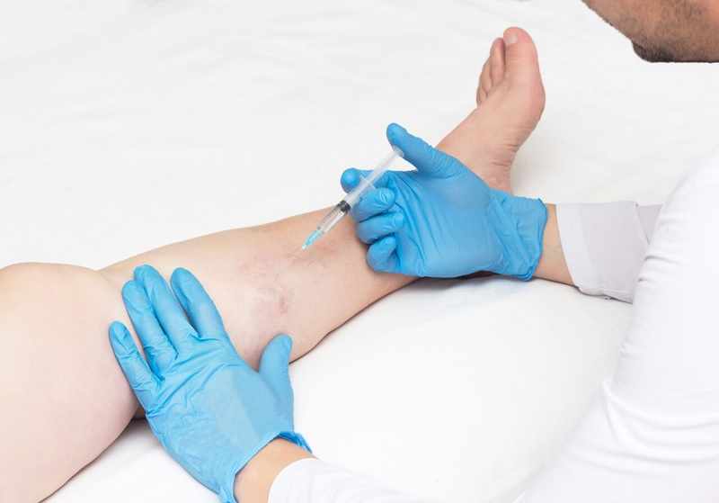 When Should You See a Vascular Doctor for Vein Issues?