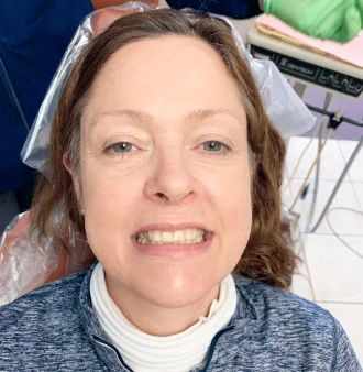 Trusted Cosmetic Dentistry Mesa AZ for Natural-Looking Result