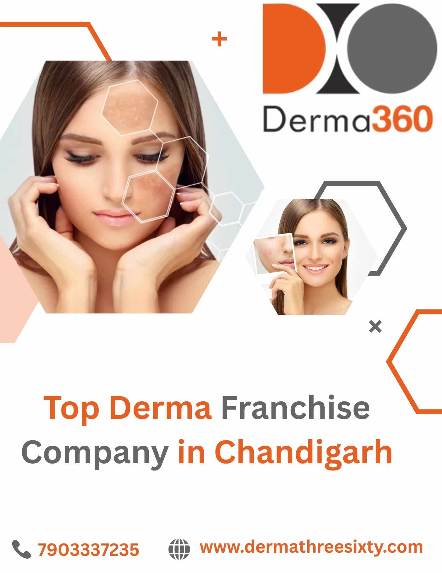 Top Derma Franchise Company in Chandigarh – Derma360