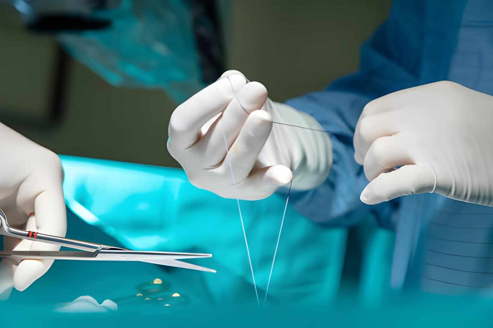 Surgical Sutures Market: Mechanisms, Innovations, and Global Outlook
