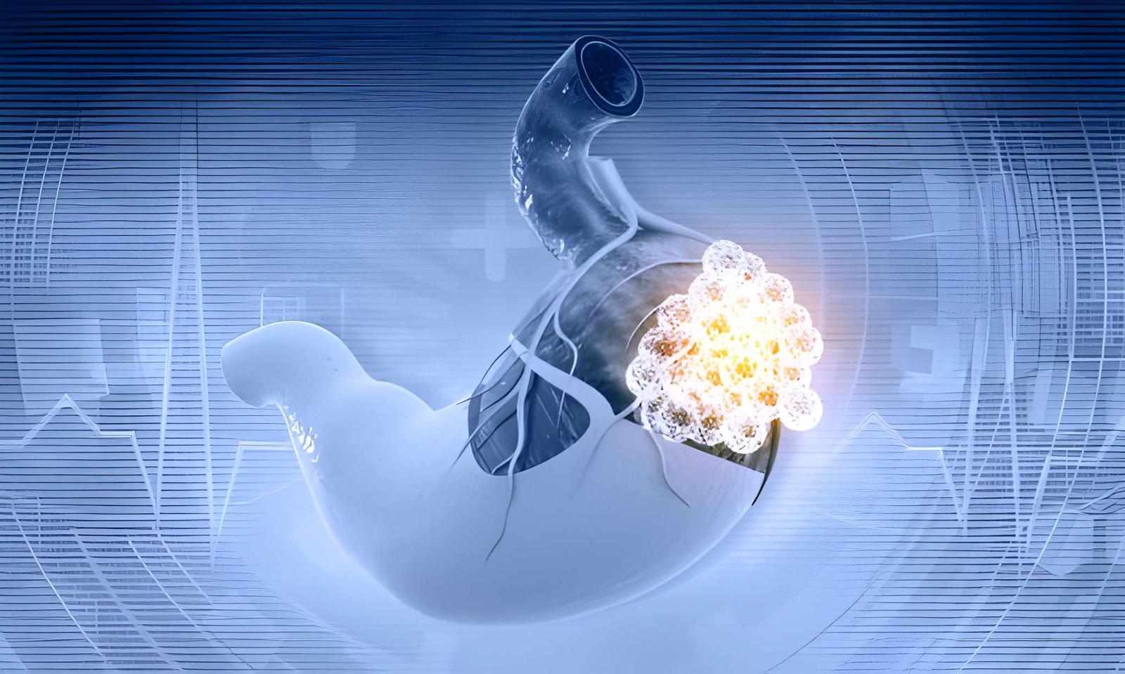 Neuroendocrine Tumors: Evolving Diagnosis, Treatment, and Market Dynamics