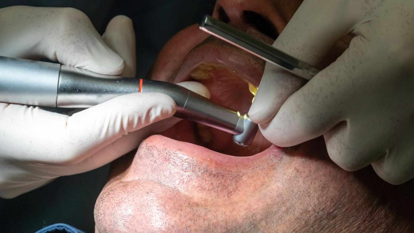 Dental Implants vs. Dentures: Which Is the Better Fit for You?