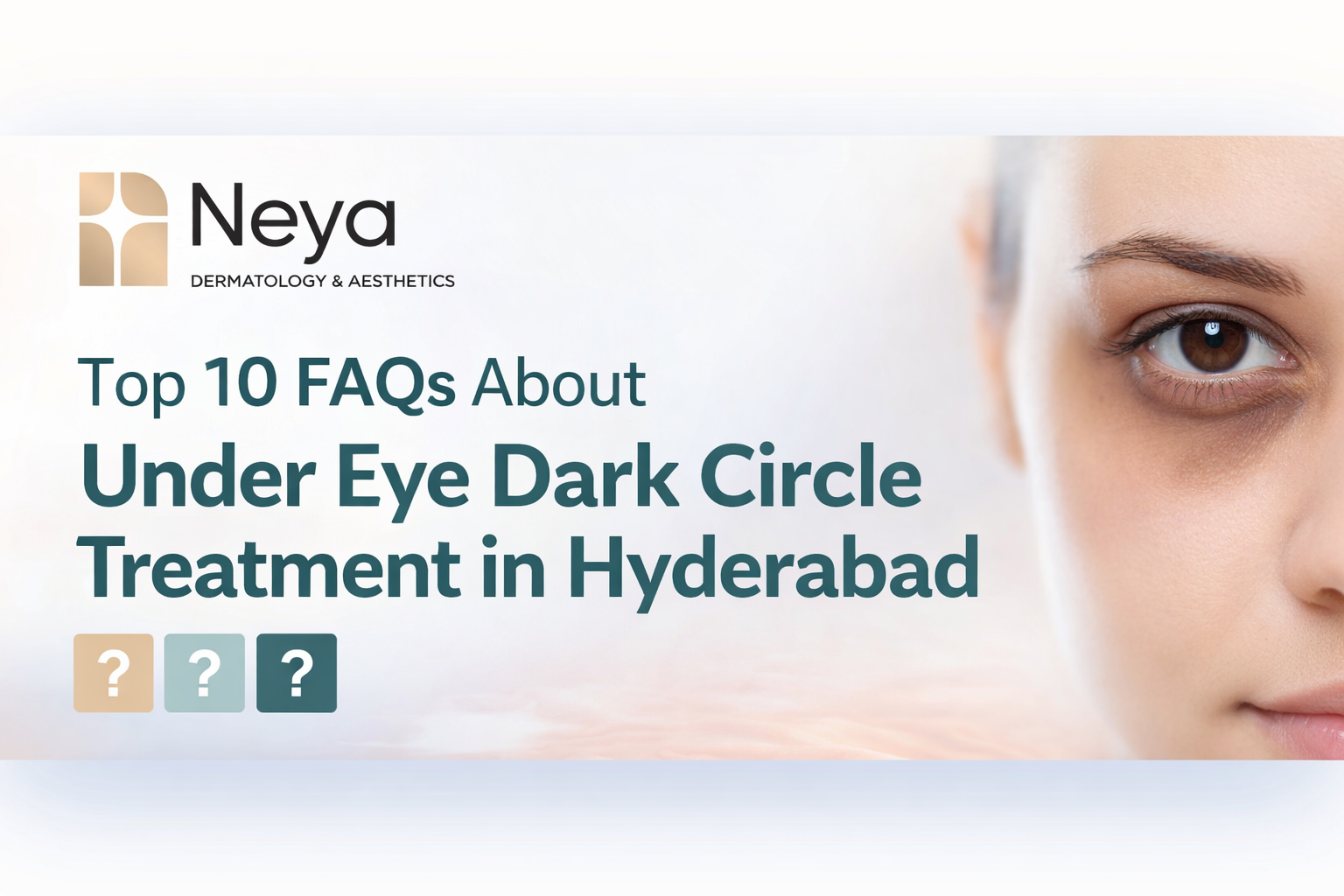 Top 10 FAQs About Under Eye Dark Circle Treatment in Hyderabad