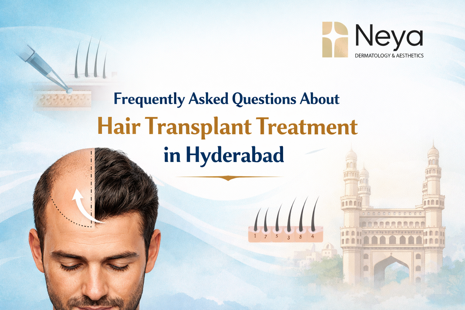 Frequently Asked Questions About Hair Transplant Treatment in Hyderabad