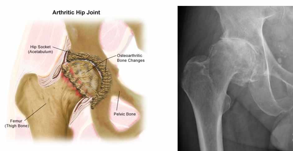 Expert Bone Care by Dr. Khitish Mohanty, Consultant
