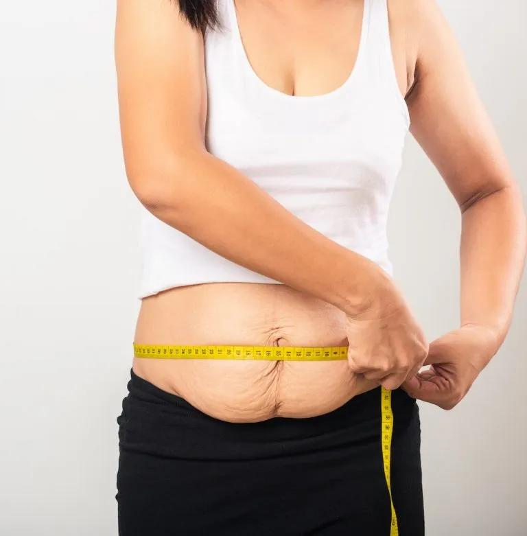 How Long Does Recovery Take After a Mommy Makeover Miami? The Part Nobody Talks About Enough