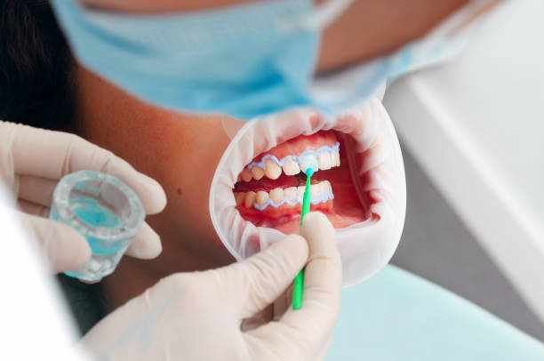 What is Basic Cosmetic Dentistry & Its Benefits