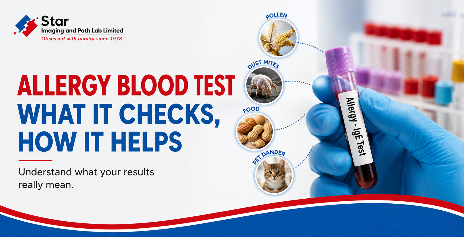 Understanding Blood Allergy Testing