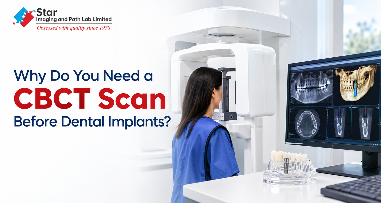 Why Do You Need a CBCT Scan Before Dental Implants?