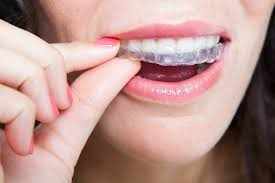 How to Transform YOUR Life and Smile FOREVER with an Incredible Corona Orthodontist