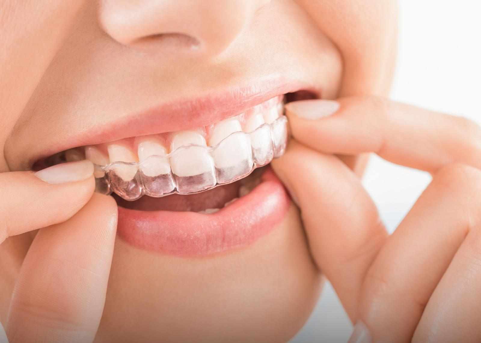 Dependable Orthodontic Solutions from GK Orthodontic
