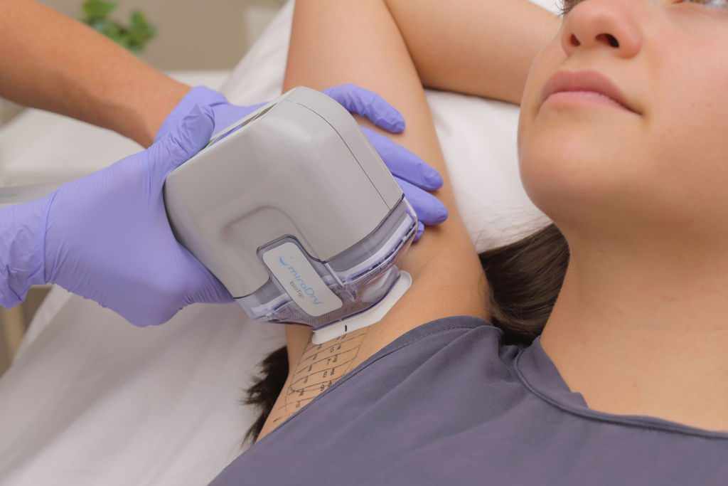 Comprehensive Information on MiraDry Sweat Treatment