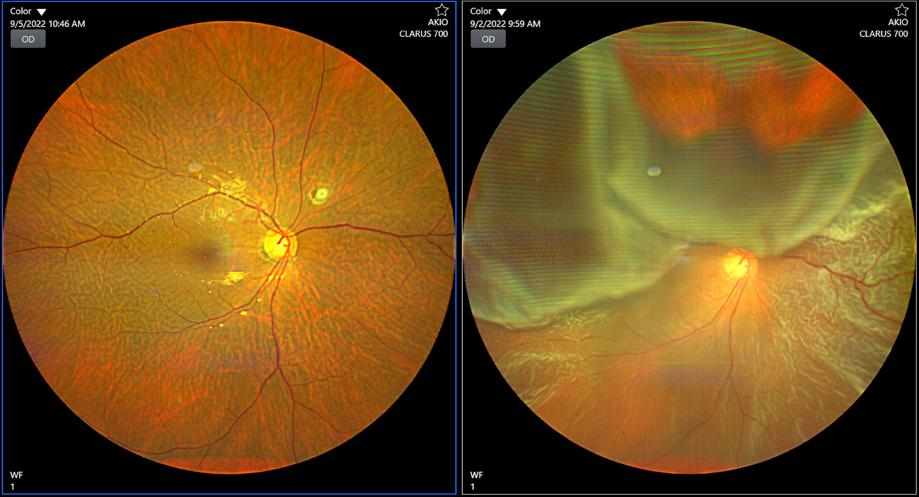 Retina Specialist in Delhi for Advanced Eye Care and Vision Protection