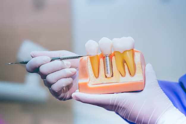 Understanding the Full Dental Implants Procedure in Ventura From Start to Finish