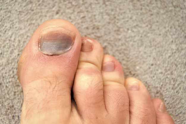 Say Goodbye to Needles: Ingrown Toenail Treatments in New York