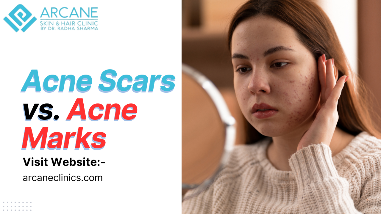 Acne Scars vs. Acne Marks