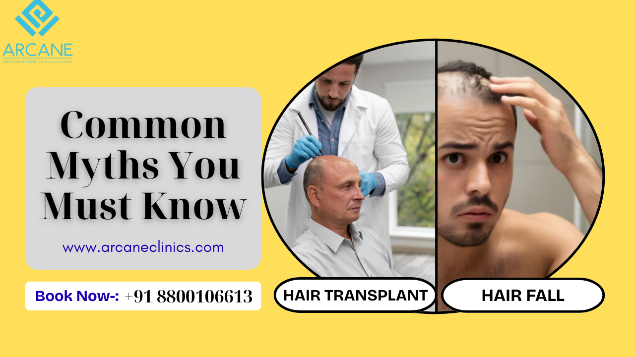 Hair Fall to Hair Transplant: Common Myths You Must Know
