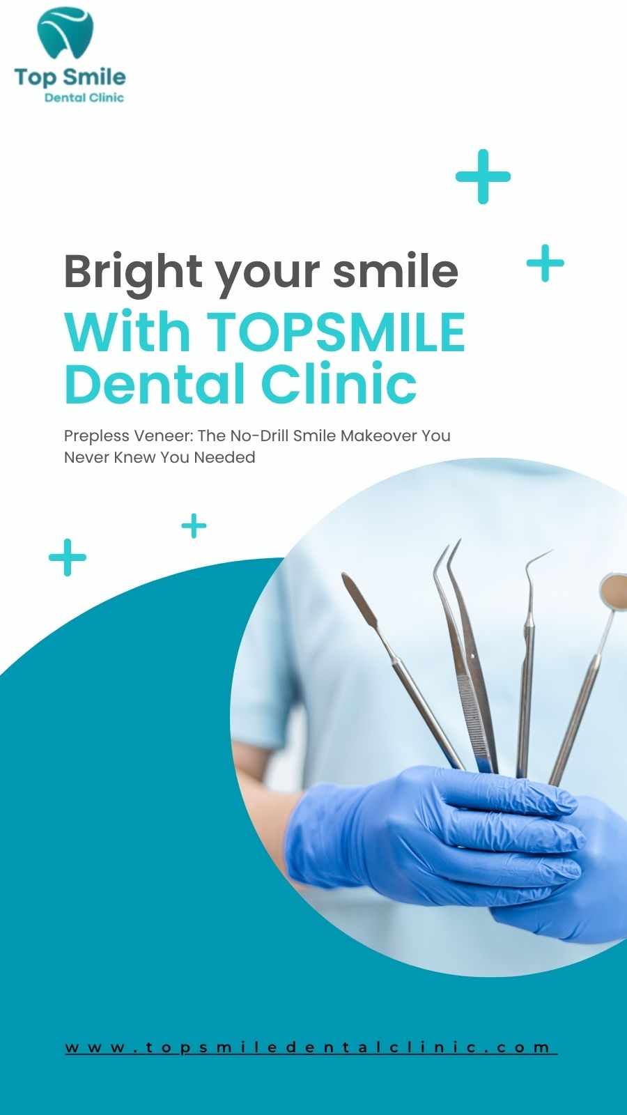 Prepless Veneer: The No-Drill Smile Makeover You Never Knew You Needed