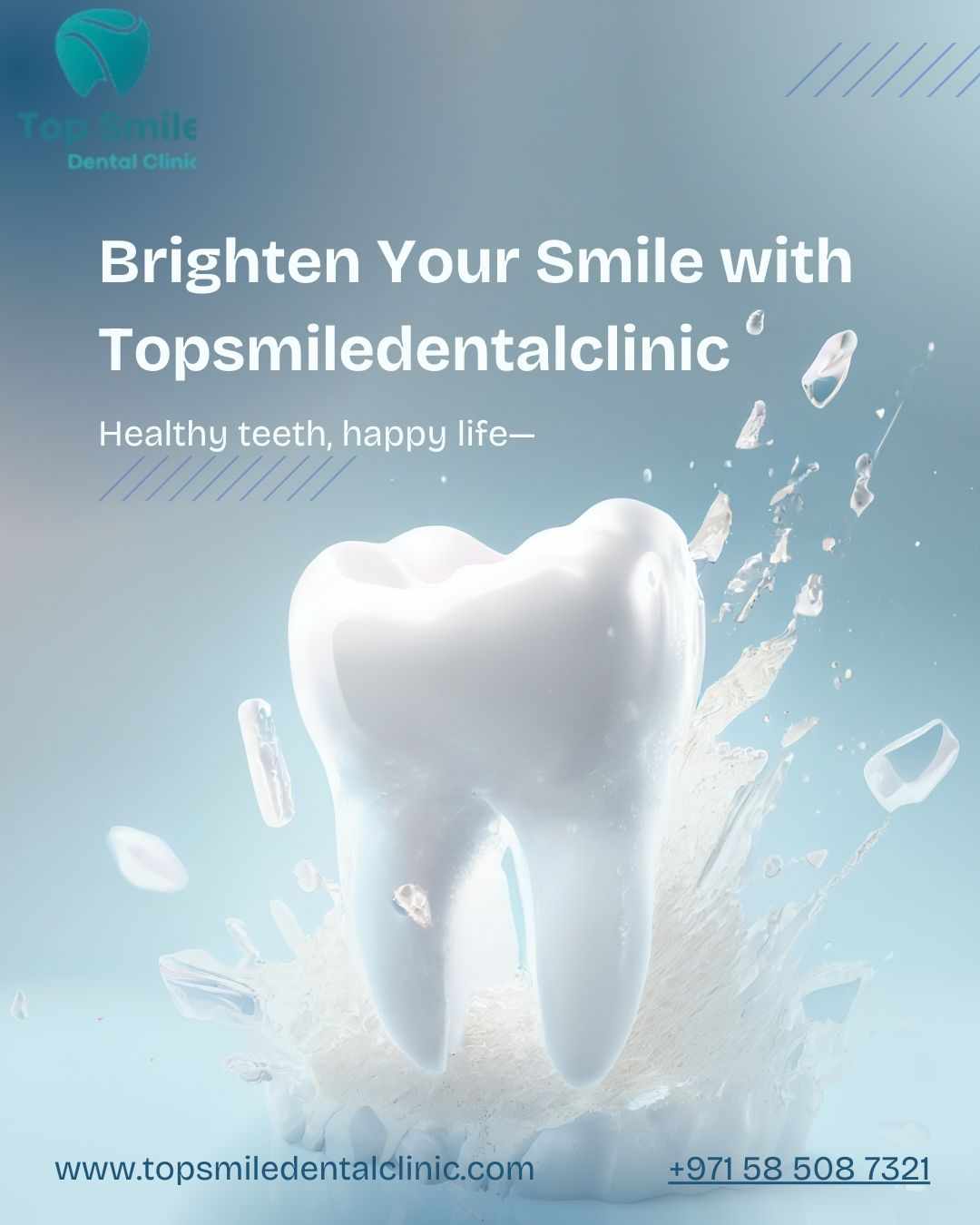 Veneers: The Modern Smile Solution for a Flawless Look