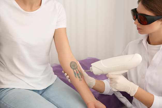 Laser Tattoo Removal in Glasgow: How It Works & What to Expect