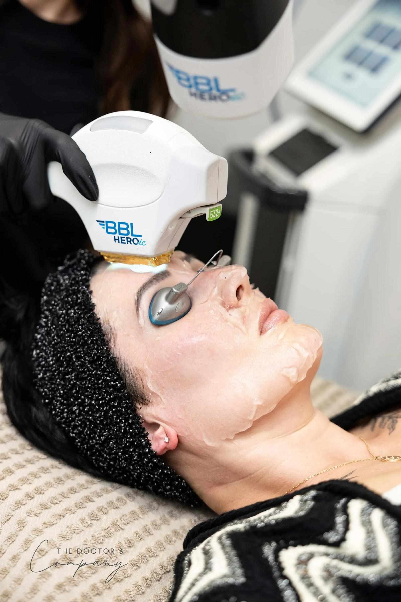 How Cheshire Clinics Are Using BBL Moxi for Radiant Skin