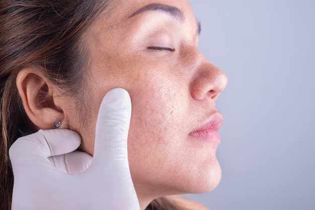 Exploring the Best Hyperpigmentation Treatment Options in Cheshire
