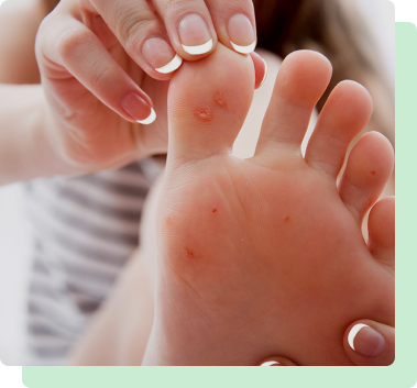 Best and top-quality Treatment For Flat Feet in South Amboy