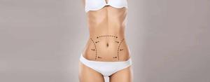 Drainless Tummy Tuck: What Is It and How Does It Compare to a Tummy Tuck with Drains - Dr. Lokesh Handa