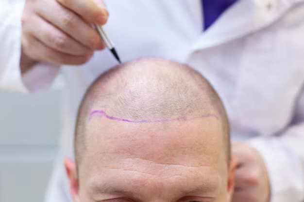 What Affects the Cost of Hair Transplants in Leicester?