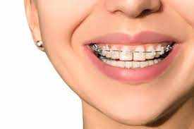 Keller Orthodontist: Committed to the Best at Keller Orthodontics, TX
