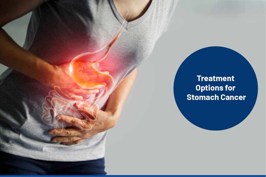 Stomach Cancer Treatment in Singapore: What to Expect