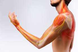 Arialief Neuropathy:  Living with Nerve Pain? Try This Natural Combo