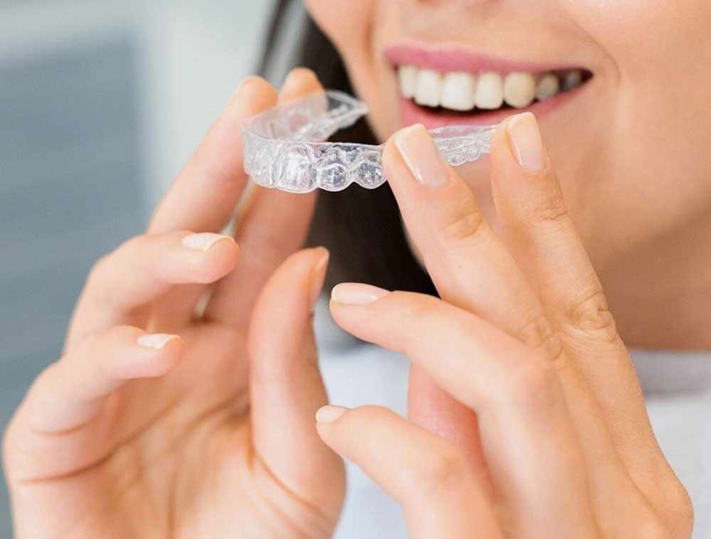 Are Dental Veneers Right For You? What Houston Patients Should Consider