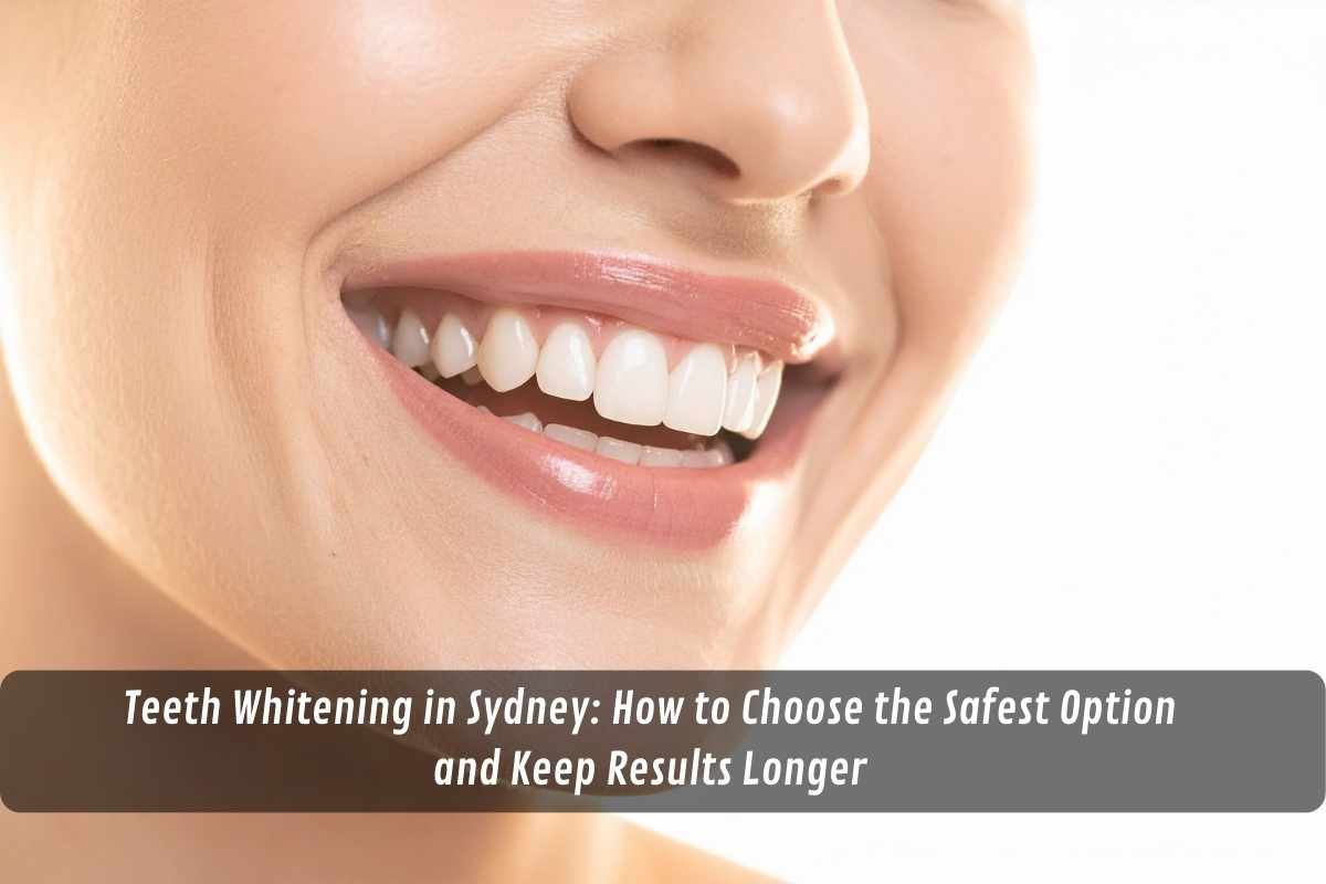 Teeth Whitening in Sydney: How to Choose the Safest Option and Keep Results Longer