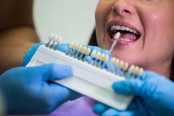 How Dental Implants Burton on Trent Can Transform Your Smile
