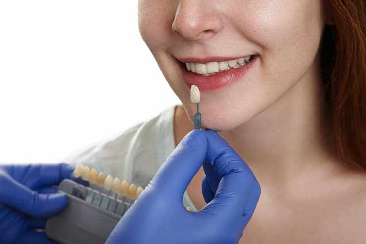 How Much Do Dental Implants Cost in Derby? Complete Price Guide