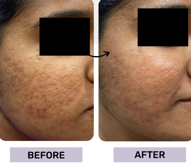 Advanced Procedures at a Skin Surgery Clinic in Maidenhead You Should Know