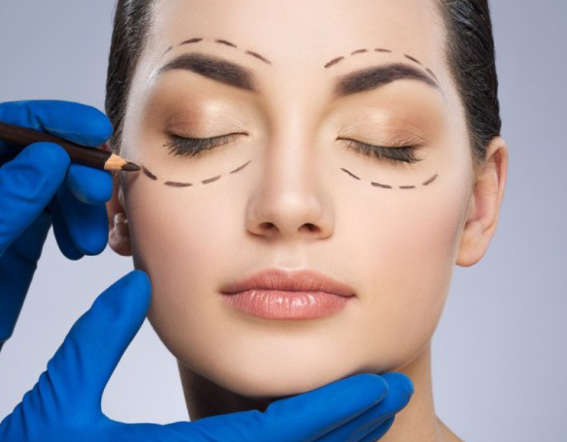 Transform Tired Eyes with Advanced Eyelid Surgery in Windsor for Confidence