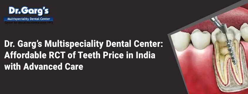 Dr. Garg’s Multispeciality Dental Center: Affordable RCT of Teeth Price in India with Advanced Care